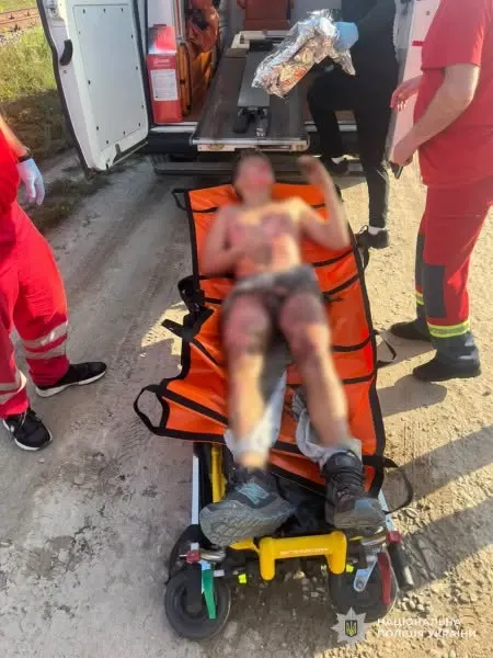 У Львові 13-річний підліток дістав опіки, злізши на цистерну заради селфі